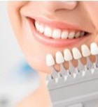 הטיפולים האסתטיים לשיניים שישדרגו את המראה בקיץ הזה-תמונה